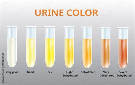 Sumar de urină: 6 cauze pentru densitate urinara mica